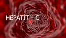 Hepatit C Siroz Belirtileri ve Tedavisi
